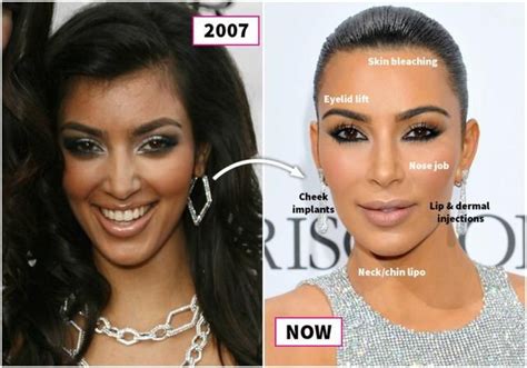 Sisters Kardashian Before And After Plastic Surgery Celebrity