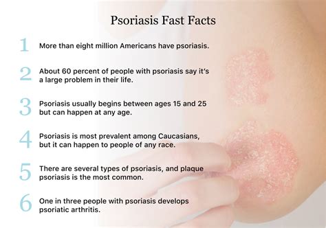 Complications Of Plaque Psoriasis Pasternak Psoriasis