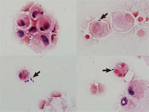 Microscopic Images Of Gram Stained Smears Of The Bronchoalveolar Lavage