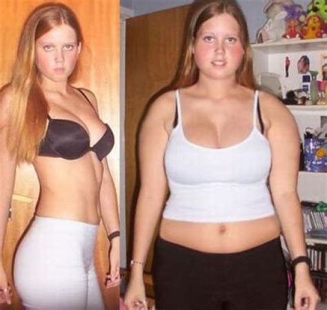 Girls Before And After Junk Food 17 Pics
