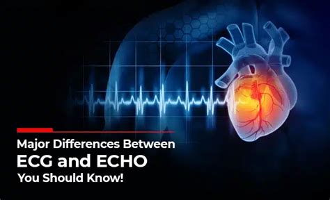 Difference Between Ecg And Echo Purpose And Result Psri Hospital