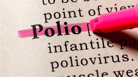 15 Fakta Penyakit Polio Menular Hingga Sebabkan Kematian
