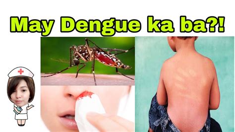 Signs Of Dengue Tagalog Dengue Home Remedies With English Subtitle