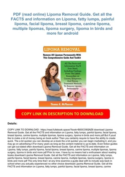 Pdf Read Online Lipoma Removal Guide Get All The Facts And
