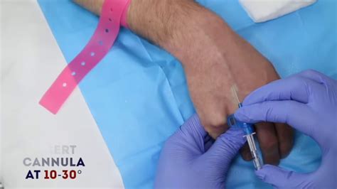 Iv Cannula Insertion In Vein Youtube