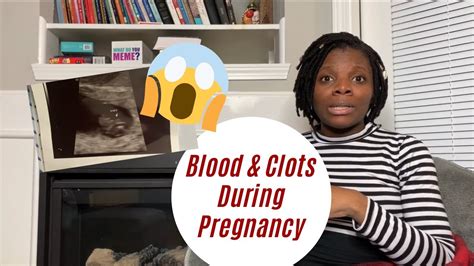 Bleeding During Pregnancy Bumpdate Subchorionic Hemorrhages Youtube