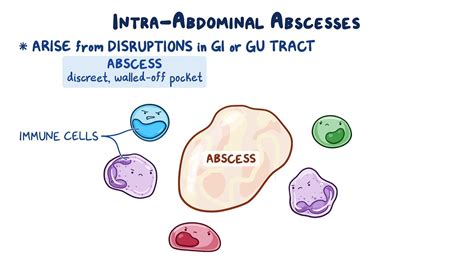 Intra Abdominal Abscess Clinical Sciences Osmosis Video Library