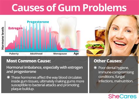 Gum Problems Shecares Hot Sex Picture