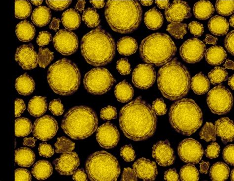 What is a Zoonosis?