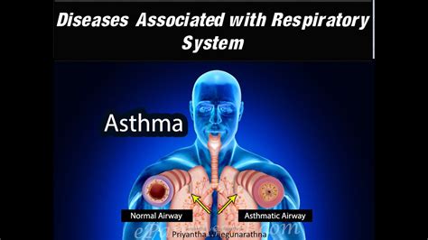 Respiratory System Diseases Associated With Respiratory System Youtube