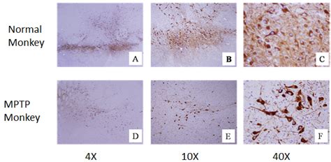 Parkinson Disease Model_CNS Models_Kunming Biomed ...