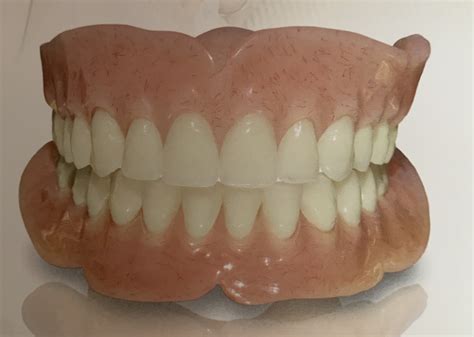 Dentures Dentist Reston Va Reston Sunrise Dentistry