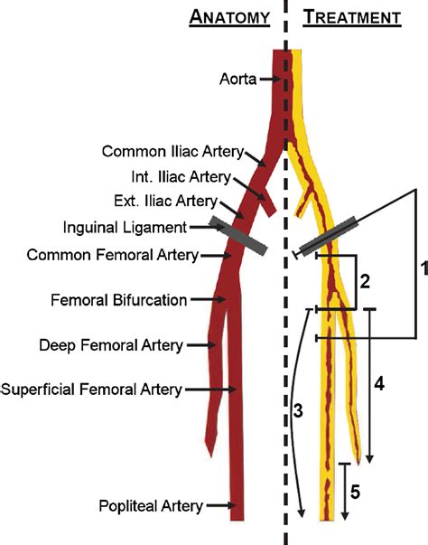 Distal Superficial Femoral Artery Images And Photos Finder