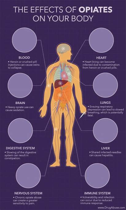 Effects Opiates Opioid Heroin Human Infographic Drugs