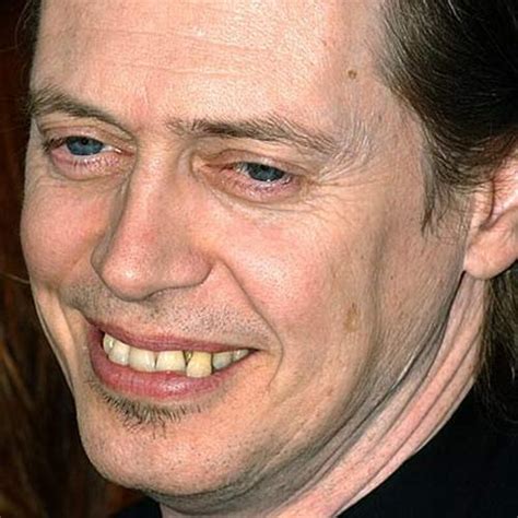 Celebrities With Bad Teeth 13 Pics Picture 11