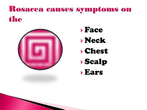Ppt Subtypes Of Rosacea And Their Symptoms Powerpoint Presentation