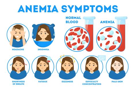Anemia Causes Types Signs Symptoms Diagnosis Test Tre