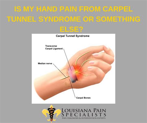 Carpal Tunnel Pain Top Of Hand My XXX Hot Girl