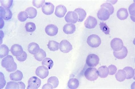 Free Picture Photo Micrograph Ring Form Plasmodium Falciparum Trophozoites Cells Infection
