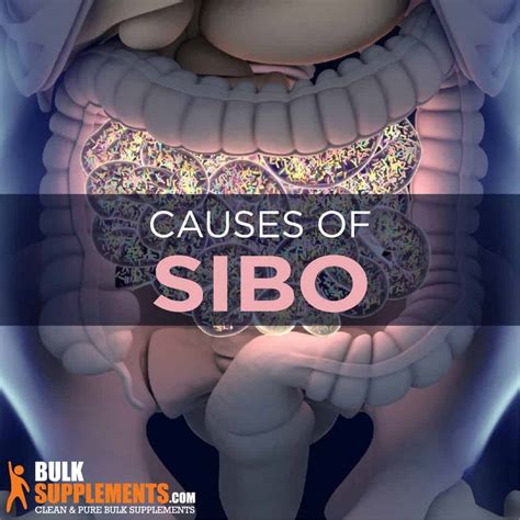 What Is Sibo Causes Symptoms Diet And Treatment