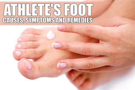 Whats The Best Home Remedy For Athletes Foot Naturelieved