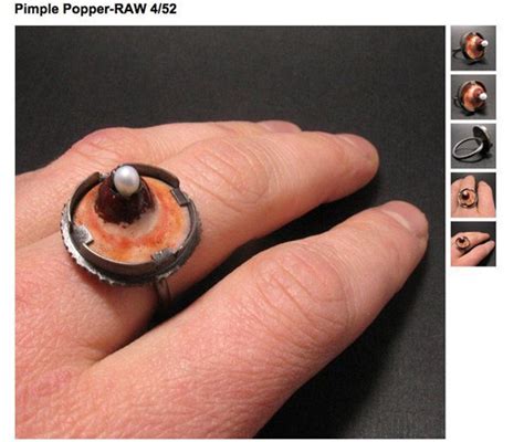 Pimple Popper Ring The Most Disgusting Piece Of Jewelry Ever Photos