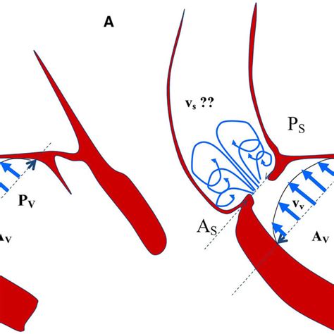 A Schematic And Ideal Representation Of Left Ventricle Aortic Valve