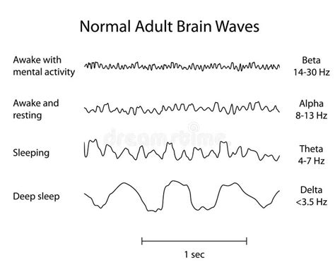 Normal Brain Waves Eeg Stock Vector Illustration Of Diagram 29444815