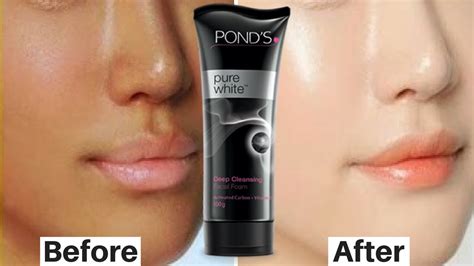 Skin Whitening Face Wash 2018 Top 10 Best Skin Whitening Face Washes