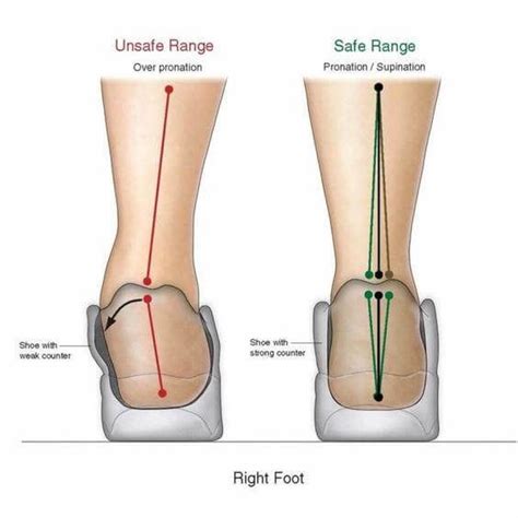 Flat Feet Overpronation Causes Treatment And Prevention Orthofeet