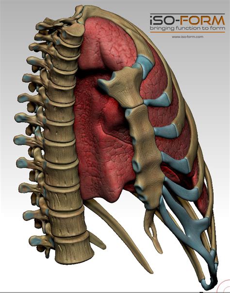 Fluid in the chest pleural effusion. Antomic model: lung, ribs and thoracic spine