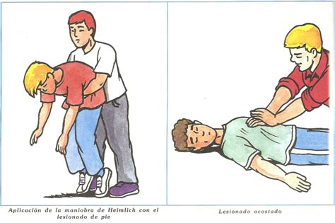 Ejemplos De Técnicas En Primeros Auxilios