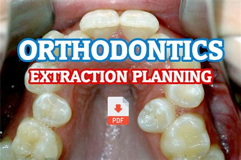 Pdf Extraction Planning In Orthodontics