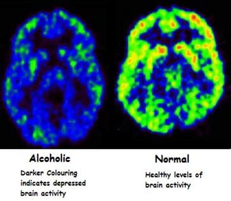 How The Brain Makes It Hard To Cut On The Booze Truth Inside Of You