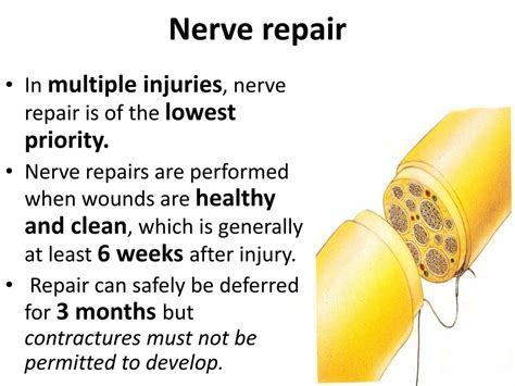 How To Rehab Nerve Damage