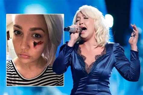 The Voices Meghan Linsey Reveals Gruesome Spider Bite Horror Im