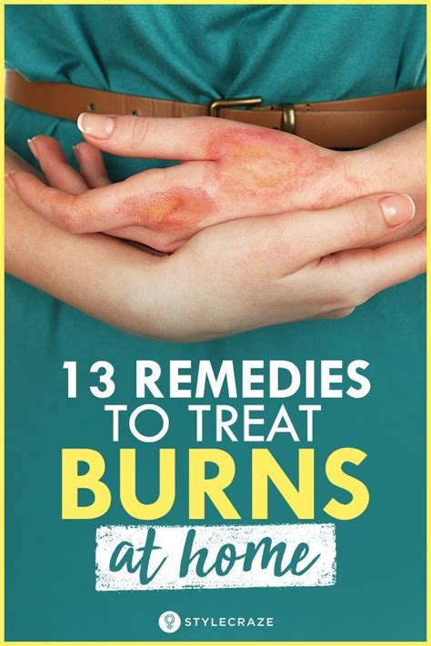 How To Treat Burns At Home 13 Natural Remedies To Try Home Remedies
