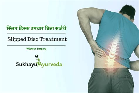 The spinal canal has limited space, which is inadequate for the spinal nerve and the. Yes You Can Get Slip Disc back to Normal without Surgery