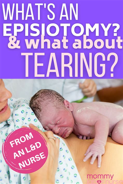 Episiotomy Vs Tearing Do You Know Which One Is Better Artofit