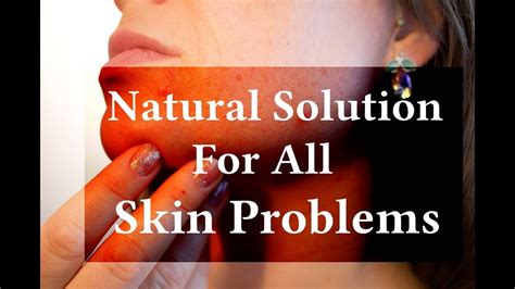 Natural Solution For All Skin Problems Youtube