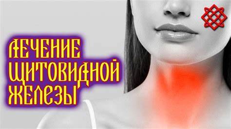 ЛЕЧЕНИЕ ЩИТОВИДНОЙ ЖЕЛЕЗЫ НАРОДНЫМИ СРЕДСТВАМИ. Как Лечить Щитовидку в Картинка - ЛЕЧЕНИЕ ЩИТОВИДНОЙ ЖЕЛЕЗЫ НАРОДНЫМИ СРЕДСТВАМИ. Как Лечить Щитовидку в