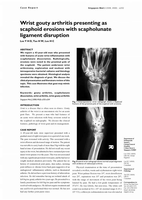 Pdf Wrist Gouty Arthritis Presenting As Scaphoid Erosions With