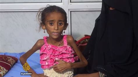 ‘nearly 600 Cholera Deaths In Yemen Over Past Month Health News Al