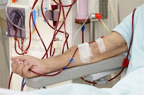 Penyakit degeneratif akibat kurang mineral. Parameter Laboratorium Baru Reticulocyte Hemoglobin ...