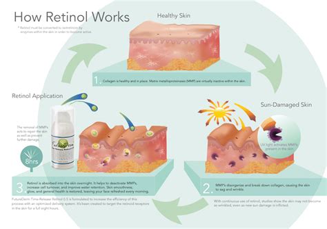 Retinol Inforgraphic Vitamin A Skin Ingredient Best Anti Aging Creams