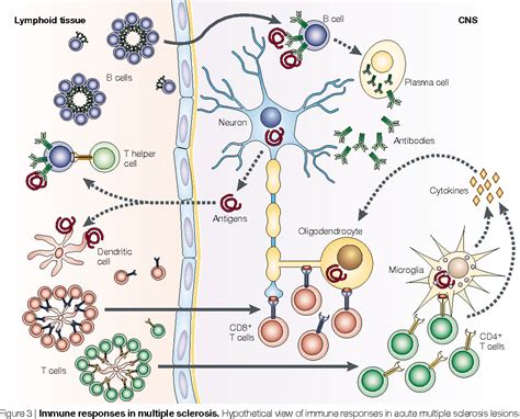 Multiple sclerosis (ms), also known as encephalomyelitis disseminata, is a demyelinating disease in which the insulating covers of nerve cells in the brain and spinal cord are damaged. Figure 3 from New concepts in the immunopathogenesis of ...