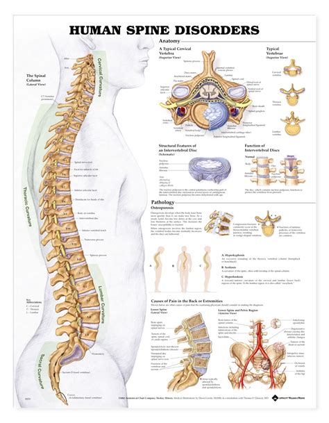 Human Spine Disorders Anatomical Chart Anatomy Models