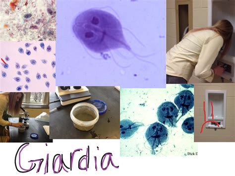 Giardiasis Biology Showme