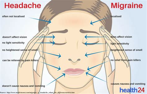 SEE Do You Have A Headache Or A Migraine Life