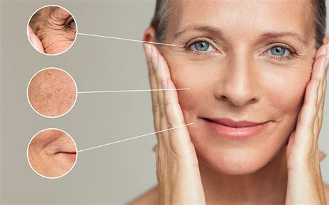 Wrinkles Causes Types Treatment And Prevention Vedix